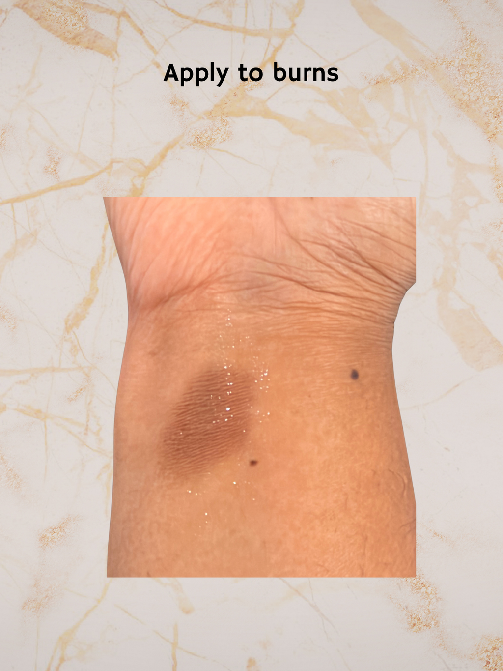 A close-up of a person's wrist with a burn mark and small white granules, under the text 'Apply to burns,' on a light marble-patterned background.